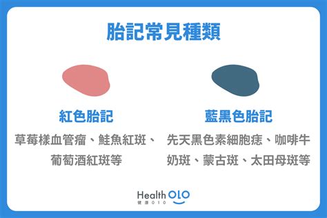 胎記消失|胎記怎麼產生、何時消除？醫師剖析胎記種類、胎記寓意